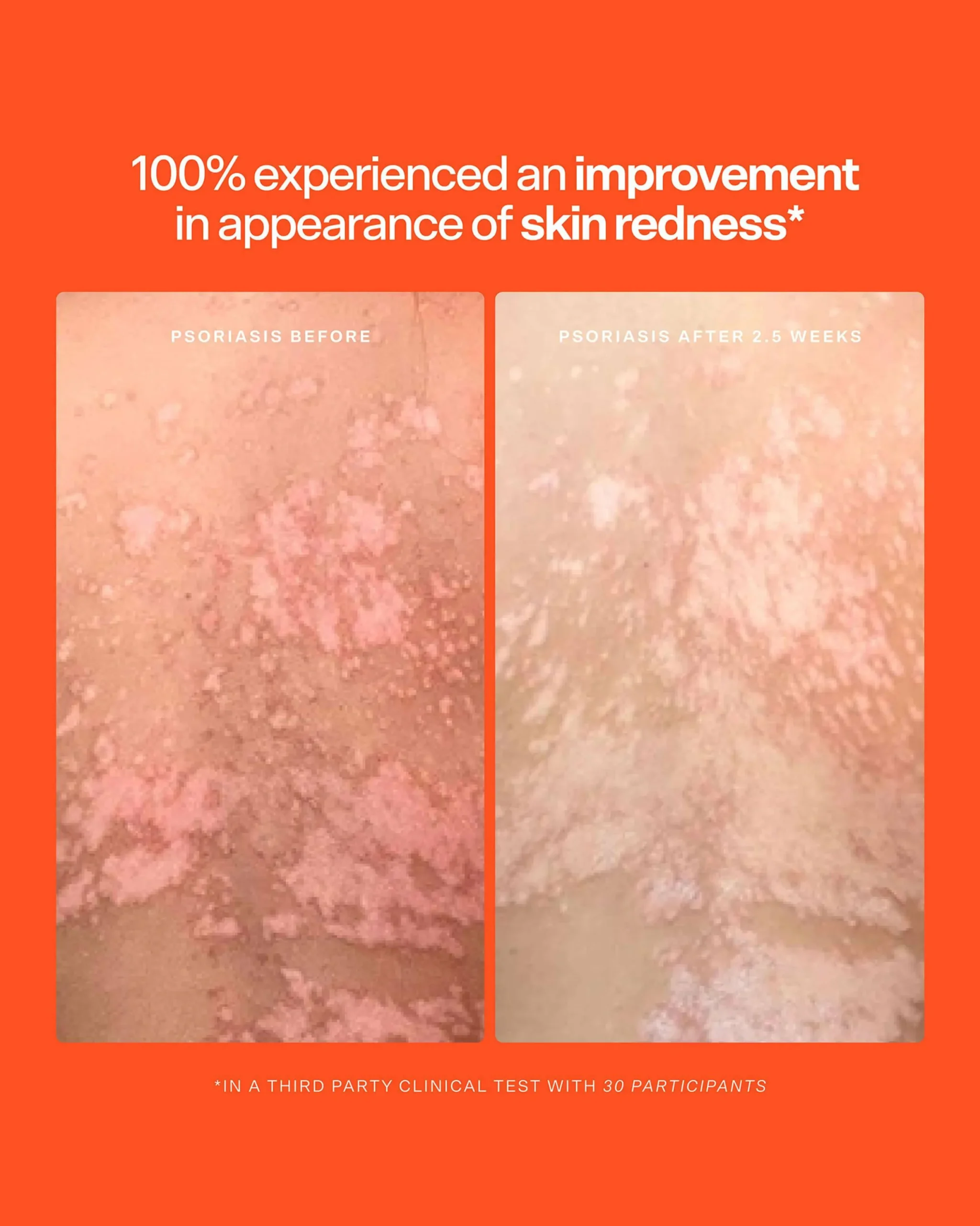 SOS Daily Rescue Spray Duo