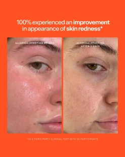 SOS Daily Rescue Spray Duo