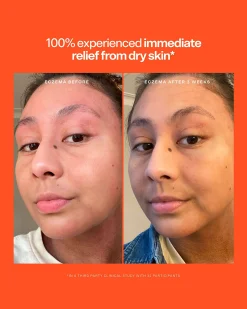 SOS Intensive Rescue Serum