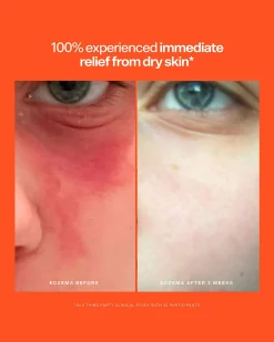 SOS Intensive Rescue Serum