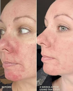Take Five Hypochlorous Acid Balancing Body + Face Spray