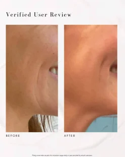 The Advanced Response Complex Face | Neck Cream