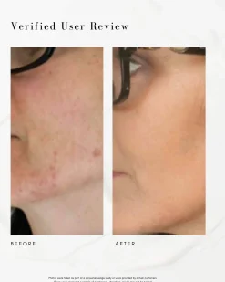 The Straight A Advanced Gentle Retinol Serum