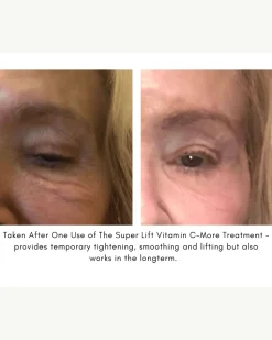 The Super Lift Vitamin C-More Treatment