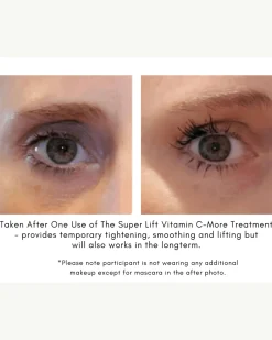 The Super Lift Vitamin C-More Treatment