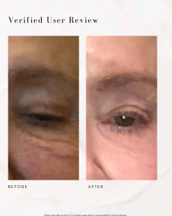 The Super Lift Vitamin C-More Treatment