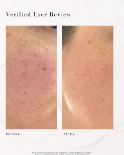 The Super Lift Vitamin C-More Treatment