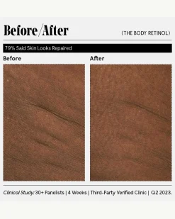 The Body Retinol
