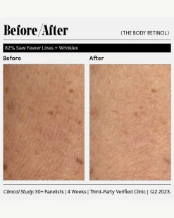 The Body Retinol