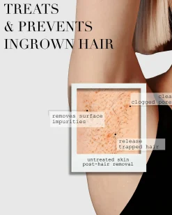 The Ingrown Bar