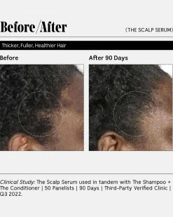The Scalp Serum