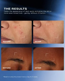Total Clarity Dark Spot Serum
