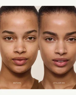 Vital Skincare Concealer