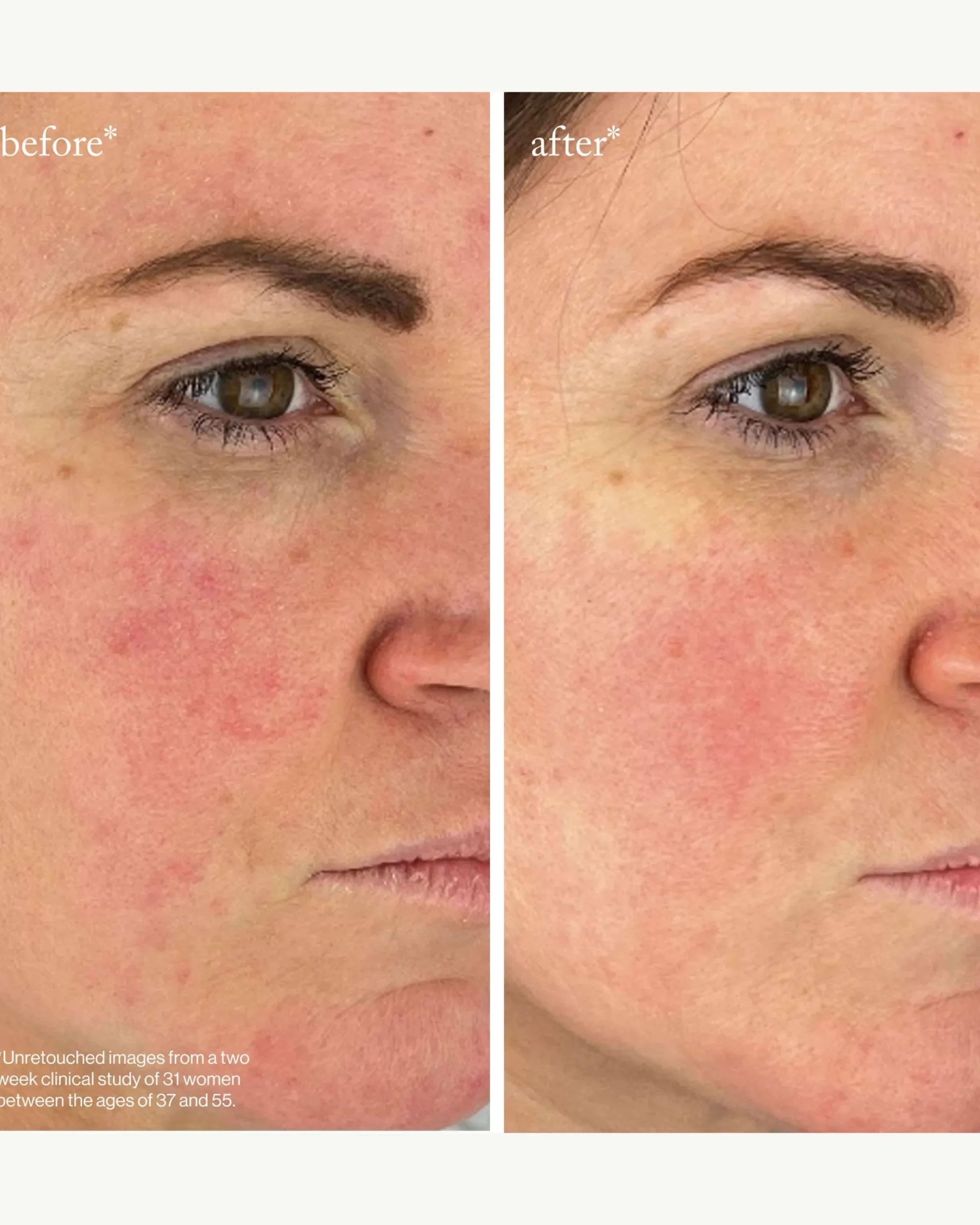 Youth-Boost Peptide Serum